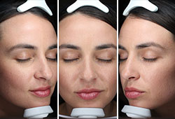 VISIA: ������ ����� ����������