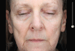 VISIA: ��������� �������� ��������