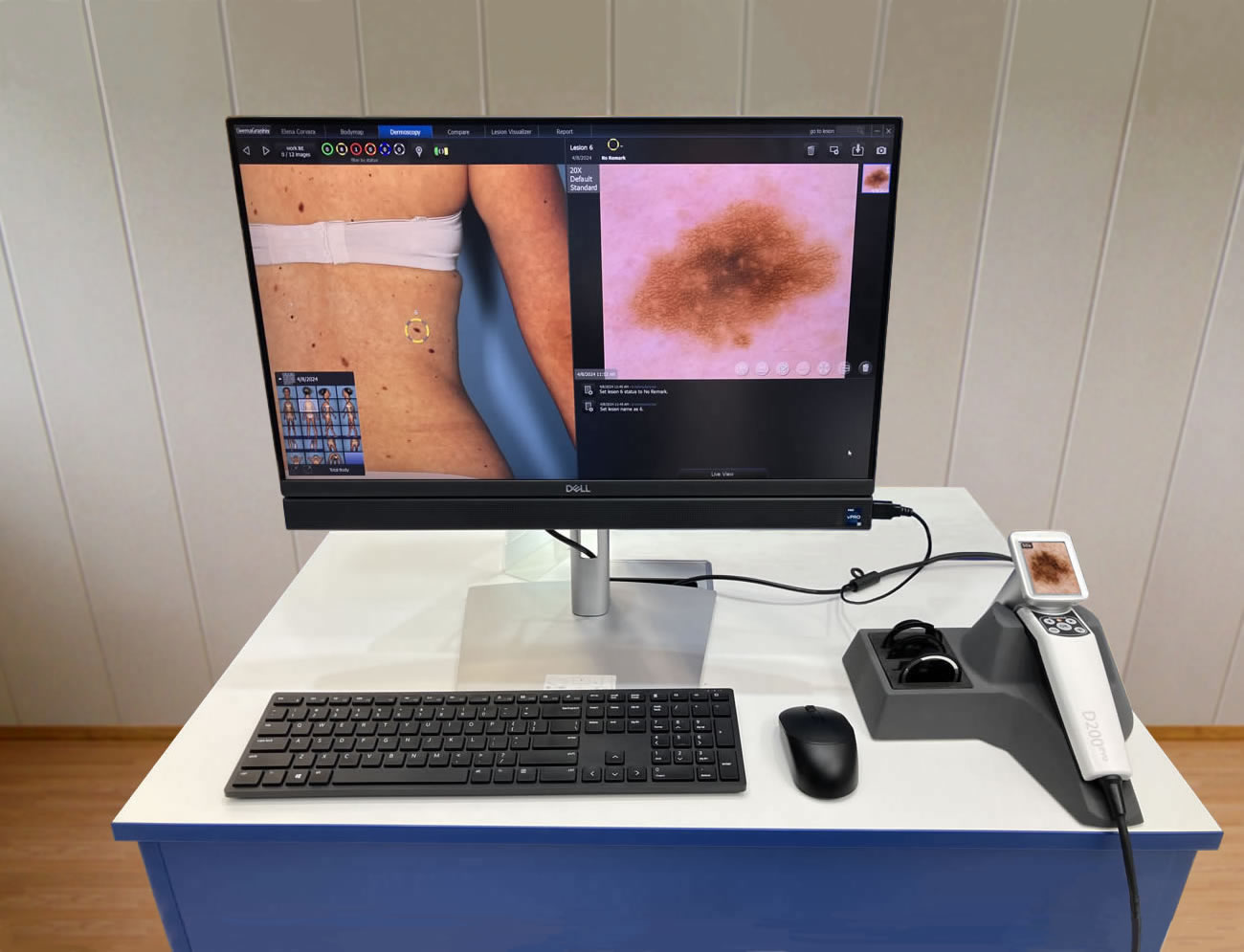 Visiomed D200: ����� ���