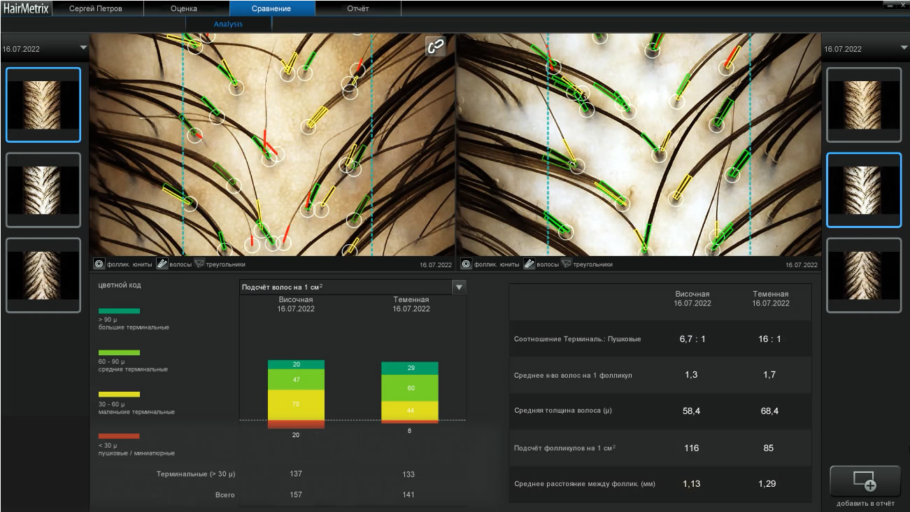 ��������� HairMetrix: ��������� ���� �����������