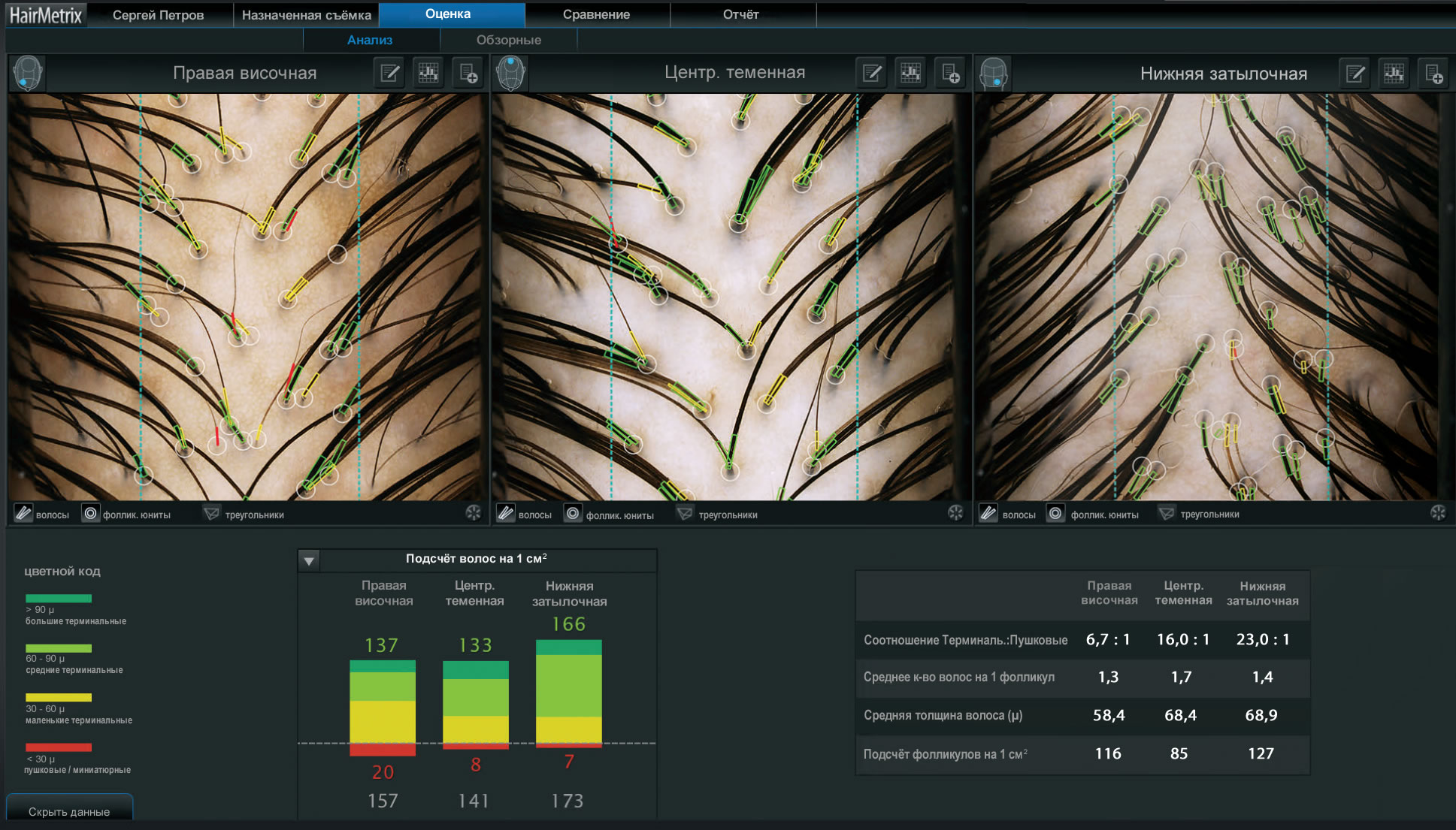 ��������� Hairmetrix: �����������