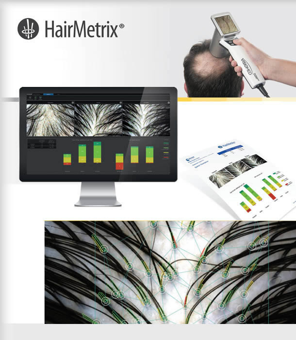 Программа для трихологии HairMetrix