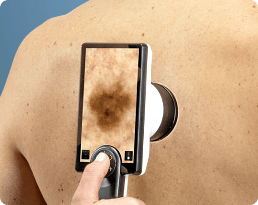 �������� ����������� D2