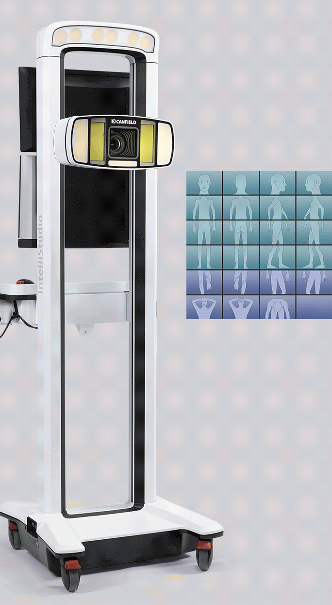 �������� ����������� IntelliStudio DermaGraphix