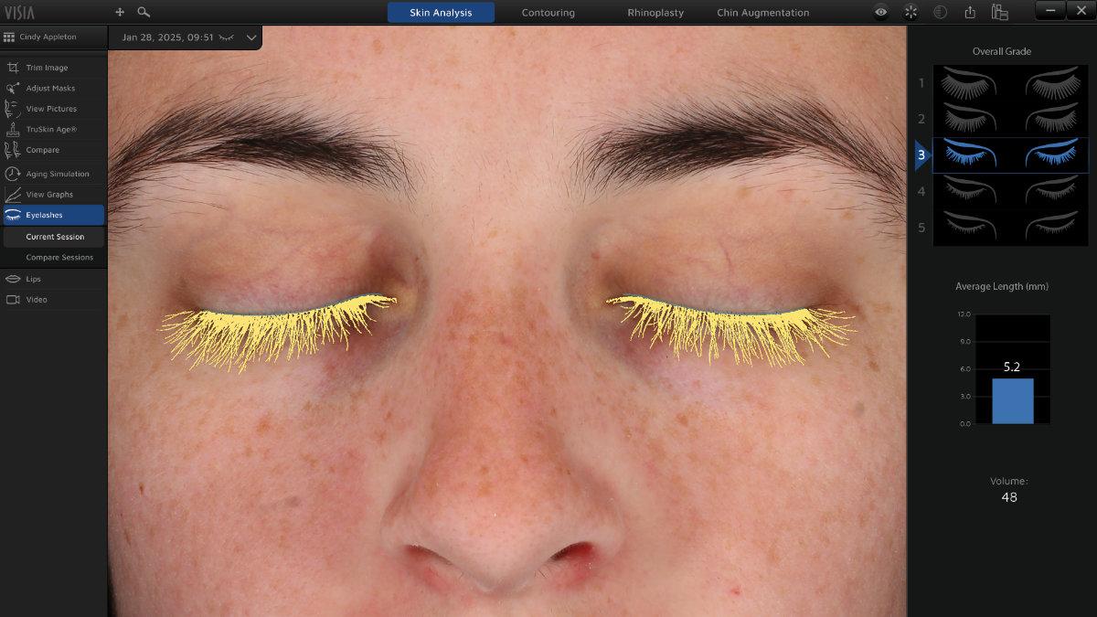 ���������� �������� �������� VISIA