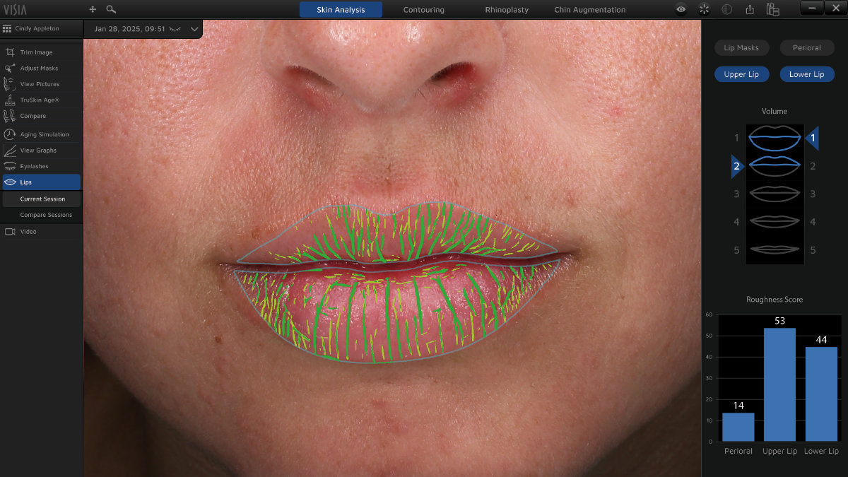 ���������� �������� �������� VISIA