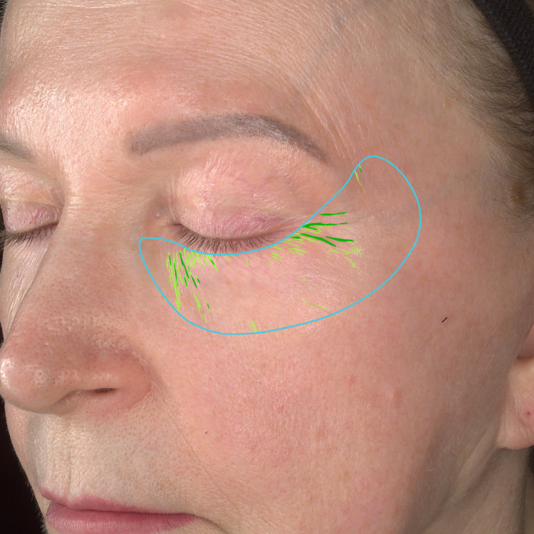 Baseline image