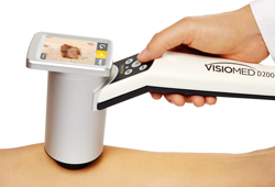 �������� ����������� Visiomed D200