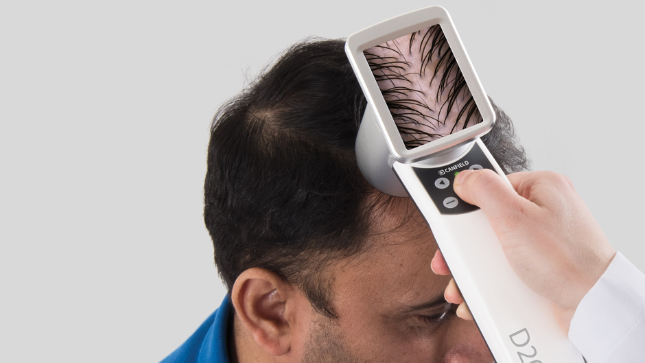 Visiomed D200: ���������� ��� HairMetrix