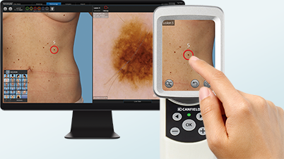 ��������� ����� ��������� ������������ Visiomed D200