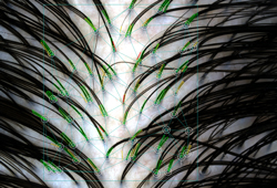 ��������� HairMetrix: ������ ������� ���������� ����� ������