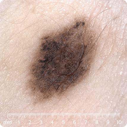 VEOS ��� �����������