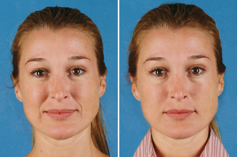 ��������� ������ �����������