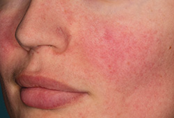 �������������� ������ ���� IntelliStudio DermaGraphix