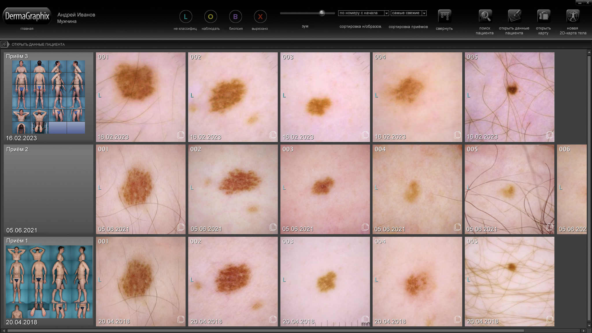 ������ ���������� ��������� DermaGraphix