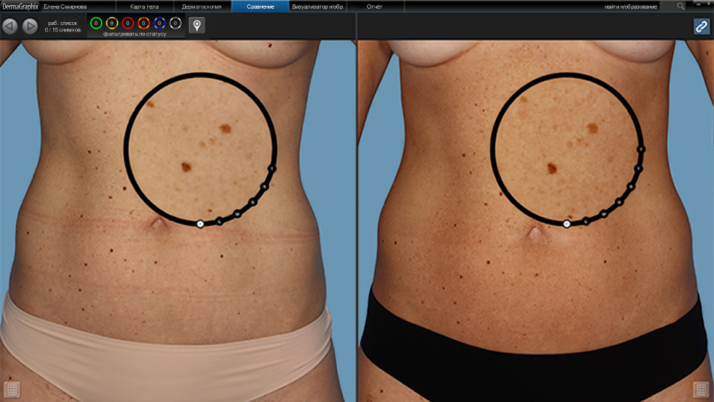 ������������ ������������ Canfield