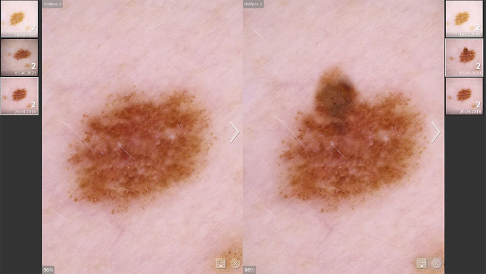 ������� ��������� ����������� ��������� DermaGraphix