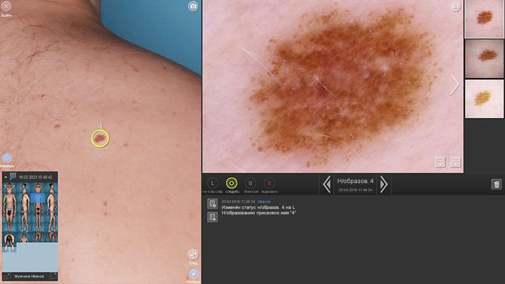 ������� ��������������� � ��������� DermaGraphix