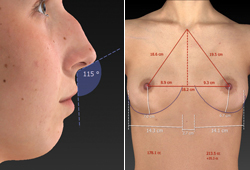 VECTRA XT: �������������� ���������