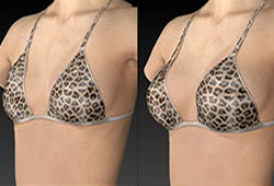 VECTRA XT: ������������ �������� ��������