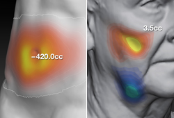 VECTRA XT: ��������� ������� �������