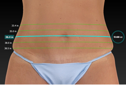 VECTRA XT: ��������� ����������� � ������� ����