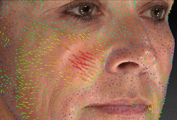 VECTRA M3: ������������ ������������ Canfield