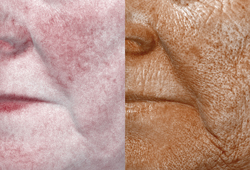 VECTRA H2: ���������� RBX