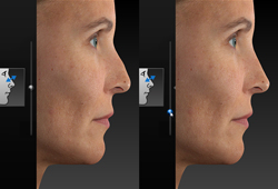 VECTRA H2: ��������� ������� �������