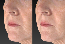 VECTRA H2: �������������� �������� �����������