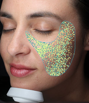 VISIA: ������������� ����������� ���� - ��������