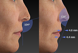 VISIA 3D: �������������� ���������