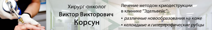 ������-������� ������ ������