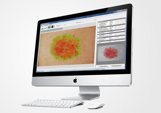 ��������� MoleExpert micro, ��������