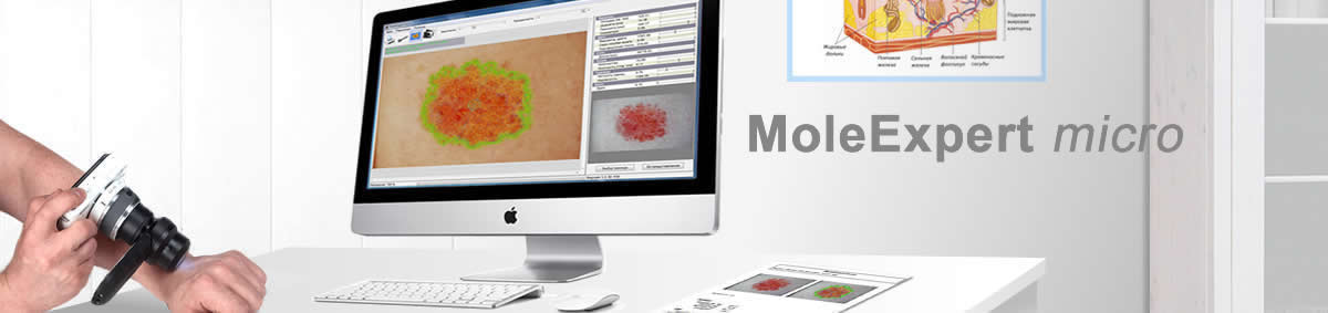 ������ ��������� MoleExpert