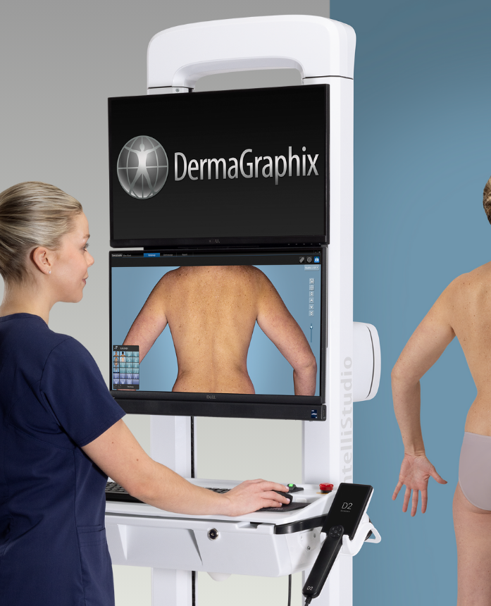 Карта тела программы DermaGraphix