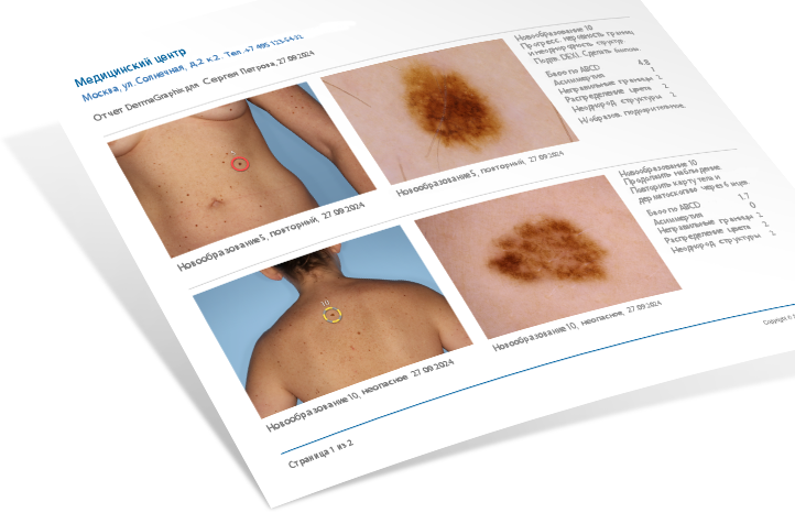 Печатный отчёт программы DermaGraphix